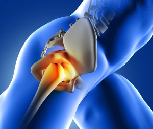 3D render of a blue medical image of close up of hip joint
